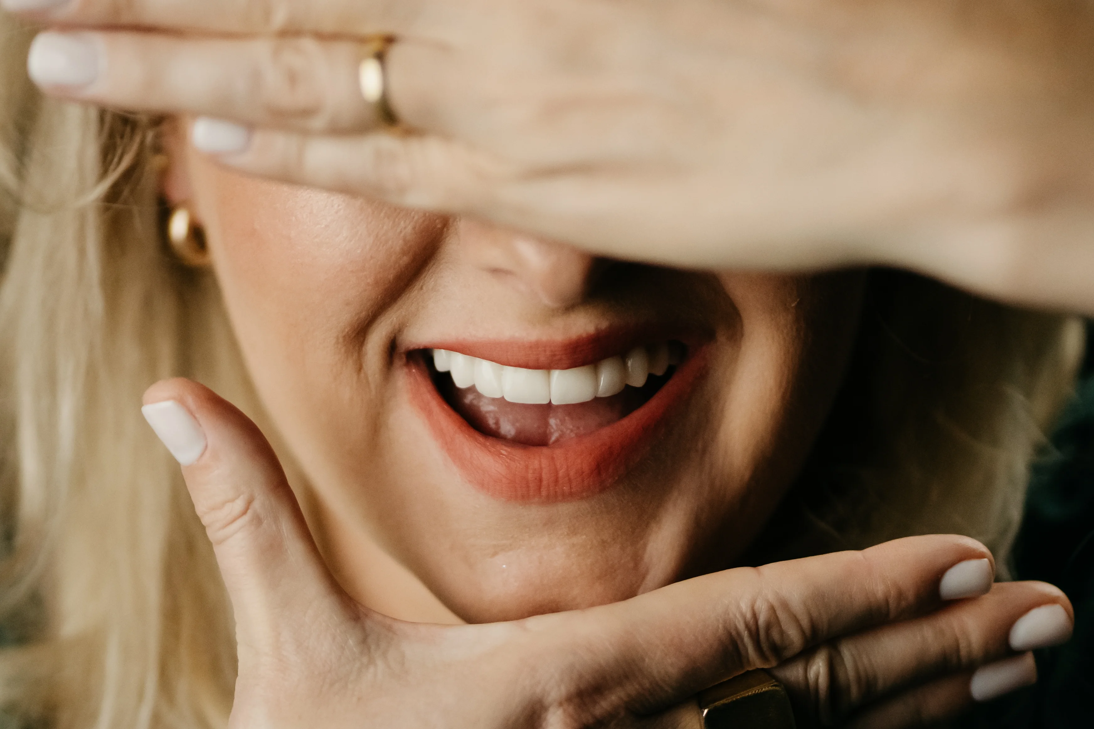 Lentes de Contato Dental